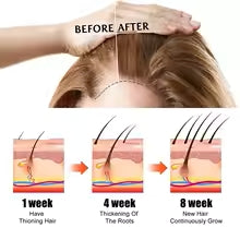 Fast Hair Growth Oil Africa Crazy Traction Alopecia Serum Anti Hair Break Thicken Hair Loss Treatment Spray For Man Women 60ML