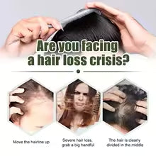 Fast Hair Growth Oil Africa Crazy Traction Alopecia Serum Anti Hair Break Thicken Hair Loss Treatment Spray For Man Women 60ML